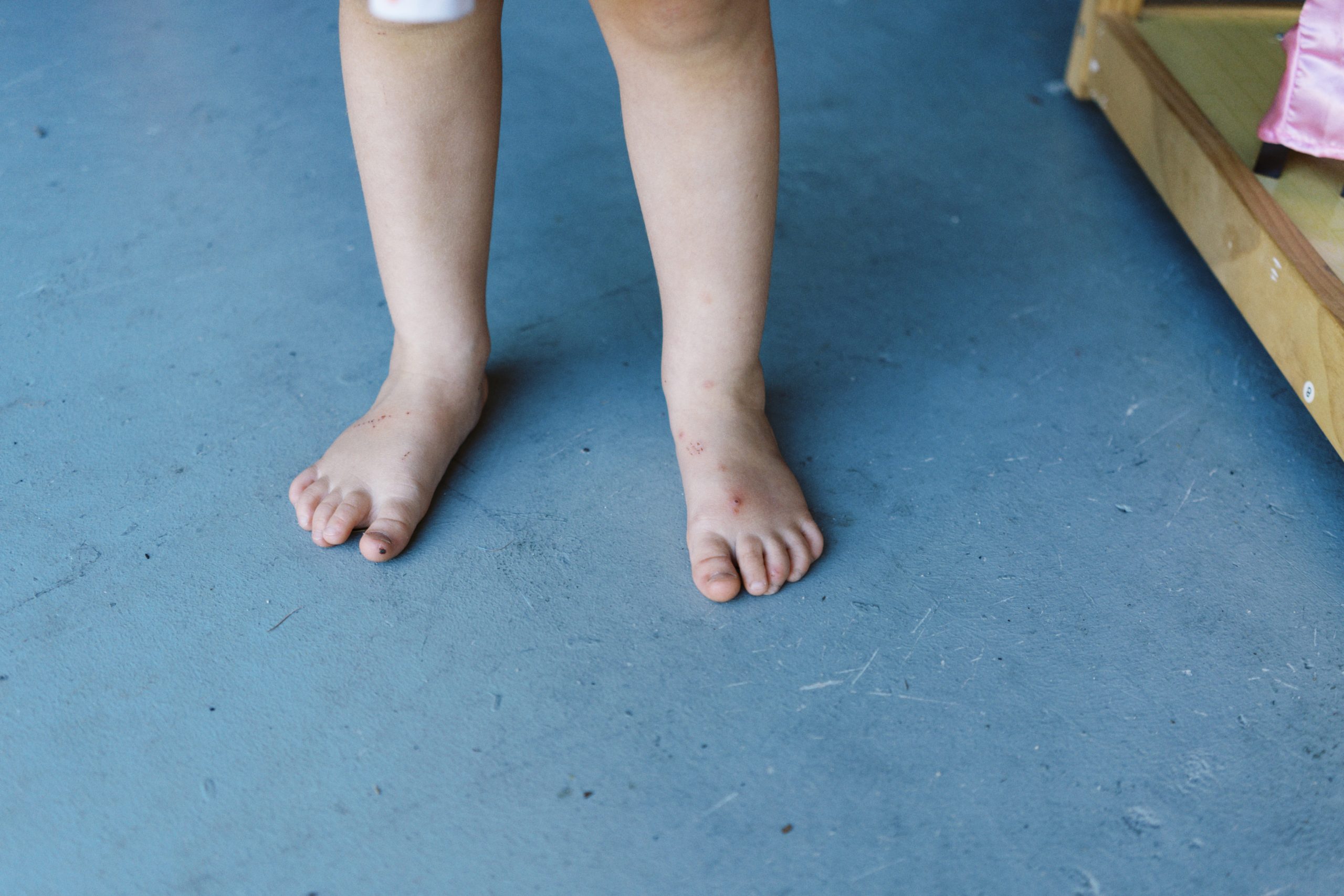 Photograph of little girl's feet from her documentary family session.